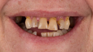Clínica Dental en Gijón