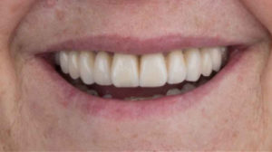 Clínica Dental en Gijón