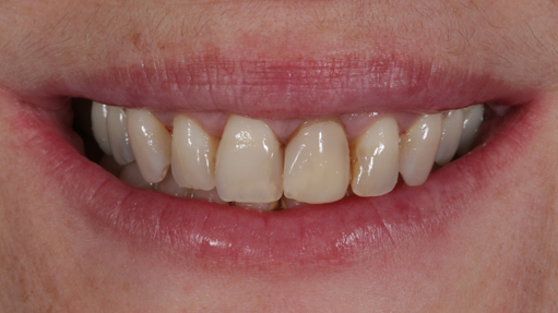 Cl铆nica Dental en Gij贸n Cl铆nica Dental en Gij贸n