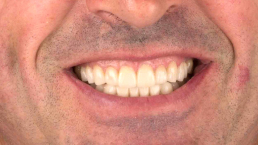 Clínica Dental en Gijón