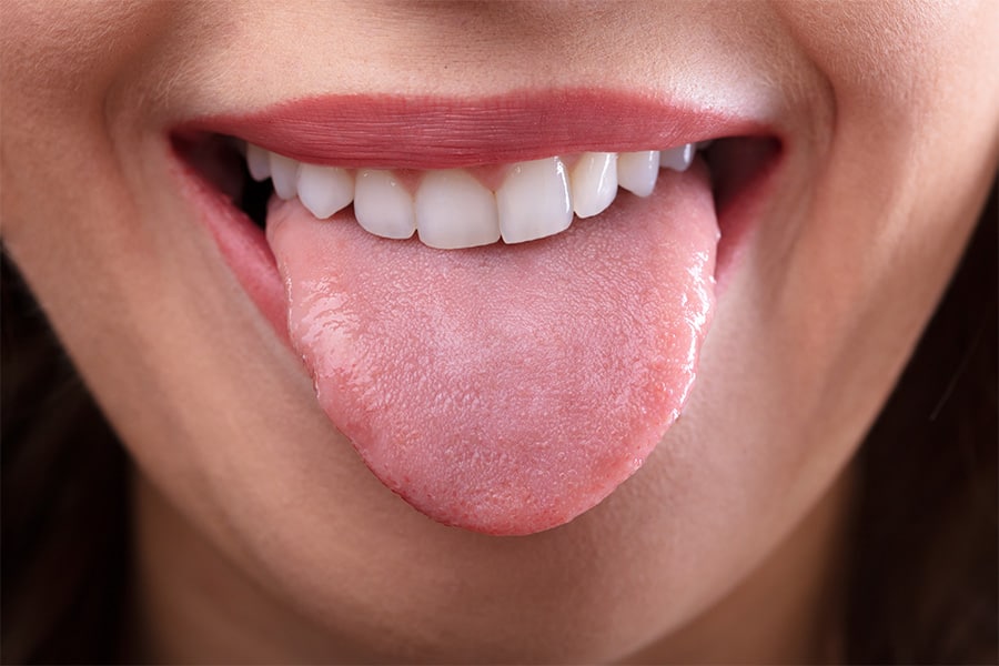 lengua sana