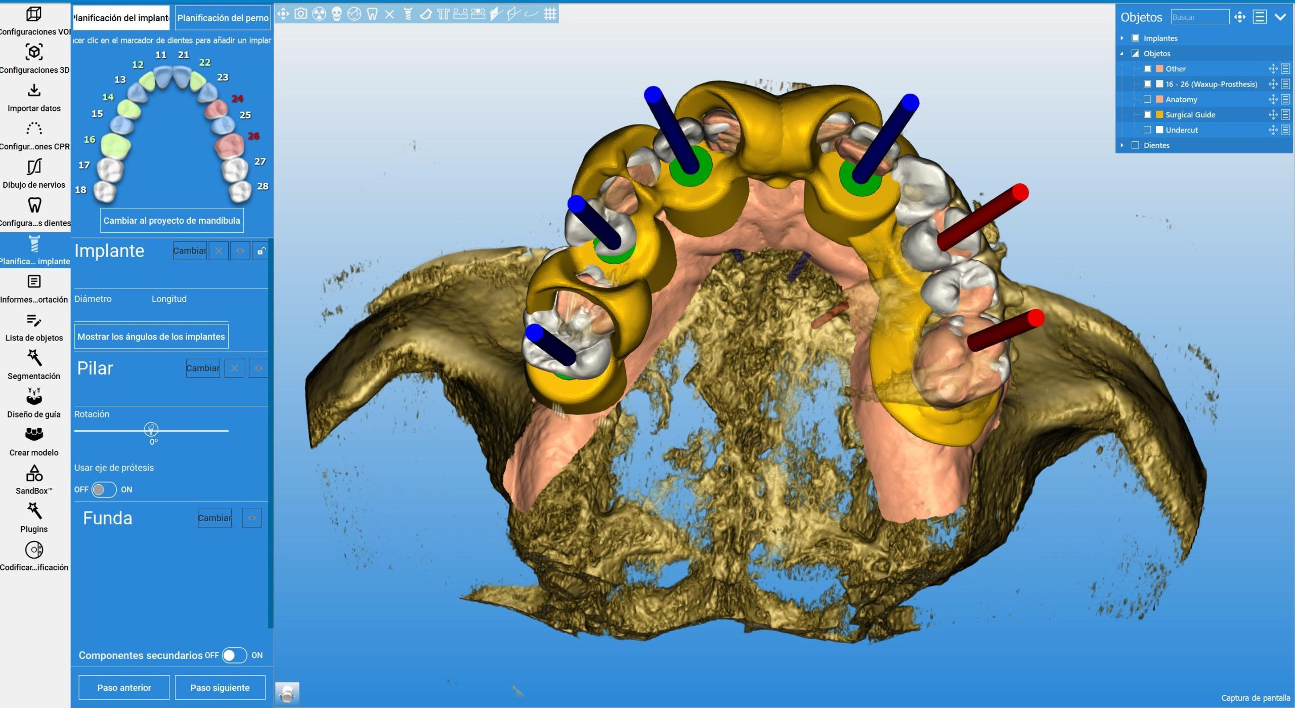 Tecnología 3D en Implantes Dentales: Precisión y Personalización