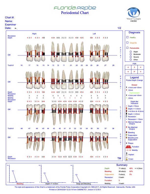 La Importancia de un Diagnóstico Temprano en la Periodoncia
