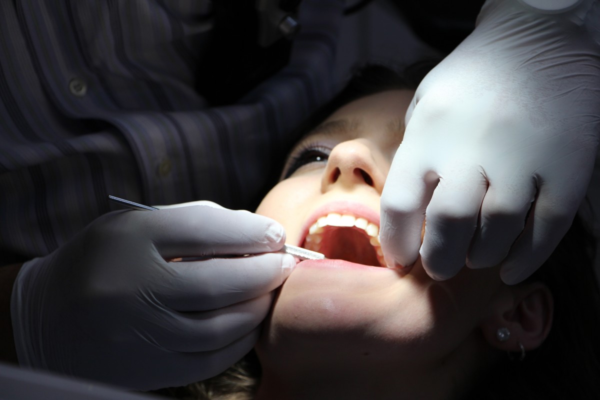 Cómo prevenir y tratar la erosión dental