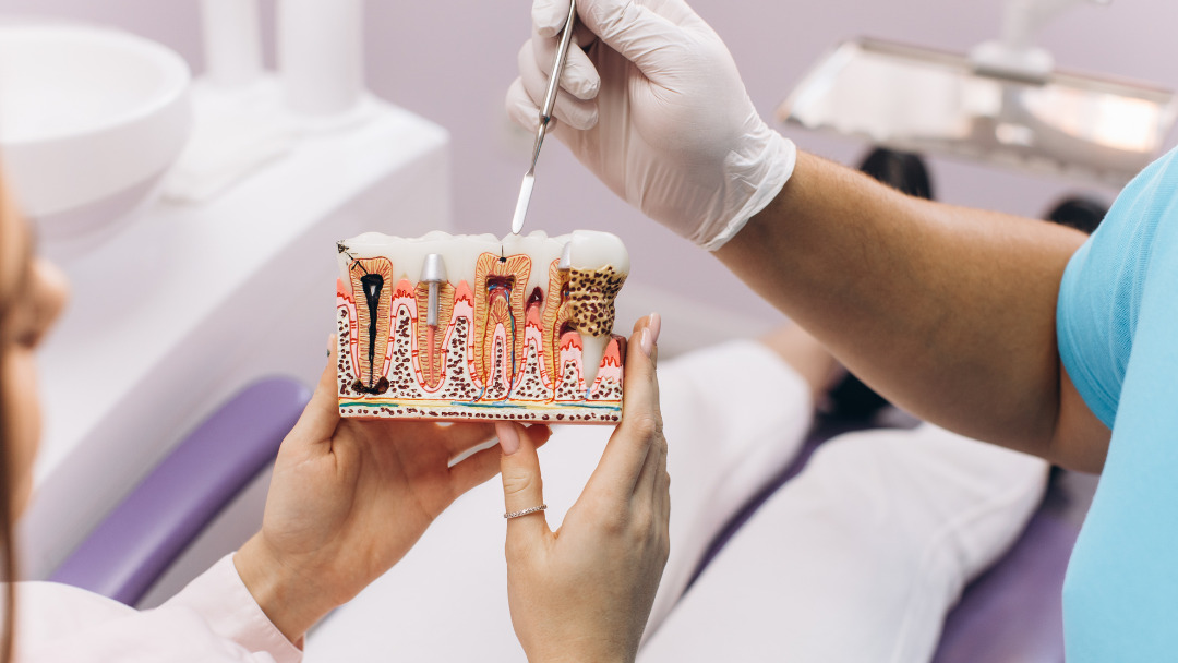 Estrategias de Prevención de la Periimplantitis en Pacientes con Implantes