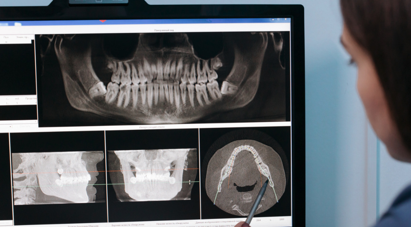Los avances en la tecnología de rayos X dentales