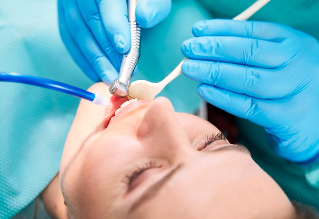 Técnicas modernas en endodoncia: lo que necesitas saber