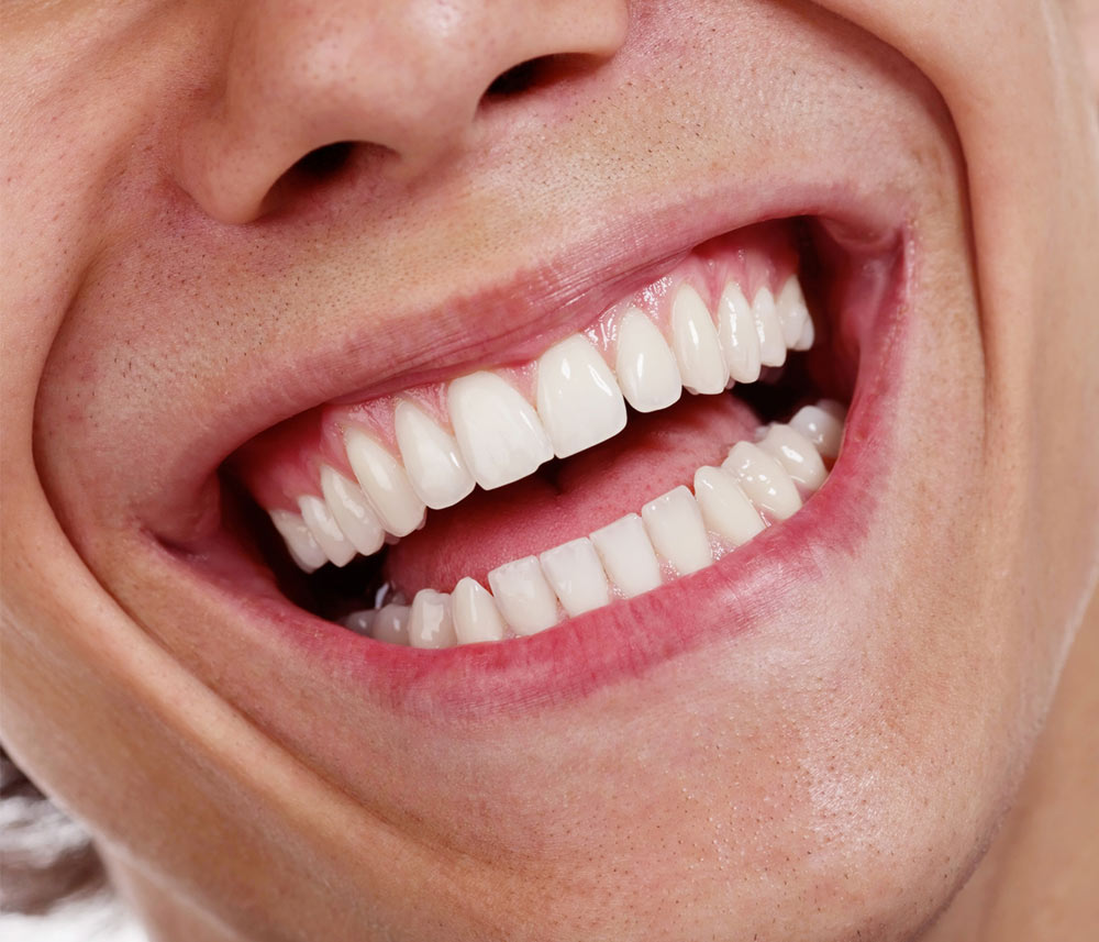 Rehabilitación dental completa: opciones y procesos
