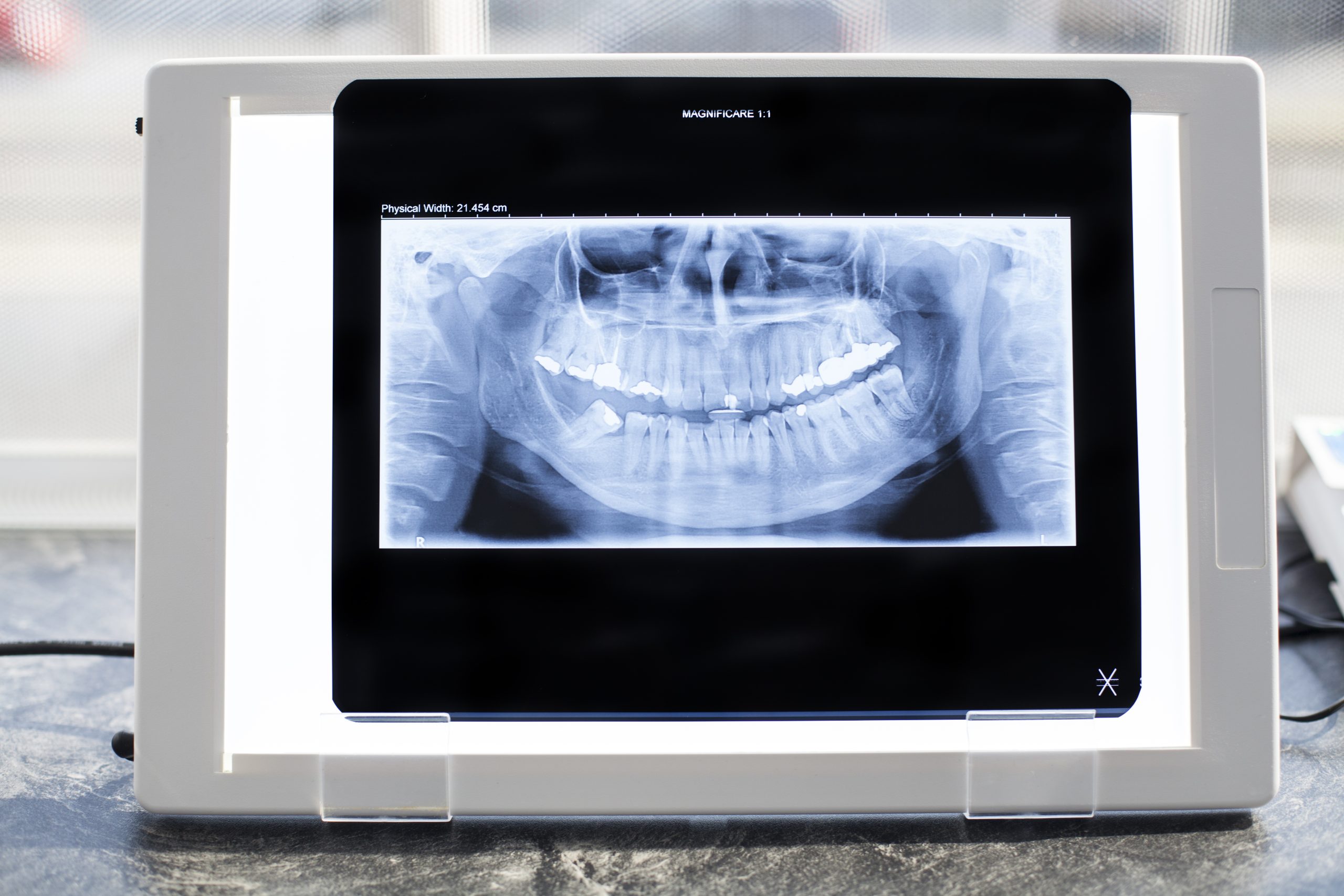 Tecnología avanzada en odontología y sus beneficios