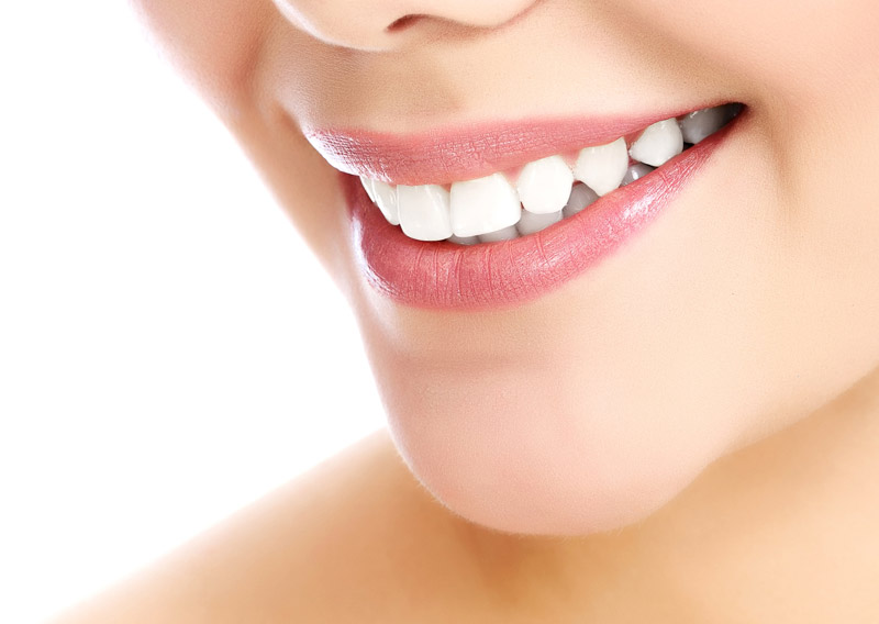 estética dental