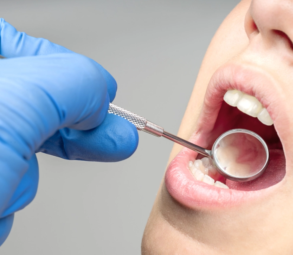 Terapia regenerativa periodontal: ¿qué es y cómo funciona?