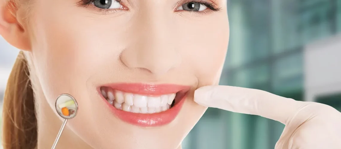 Cuidados y mantenimiento de las carillas dentales