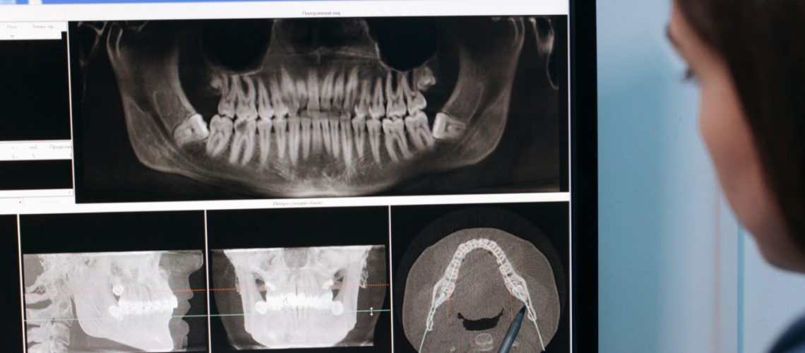 Los avances en la tecnología de rayos X dentales