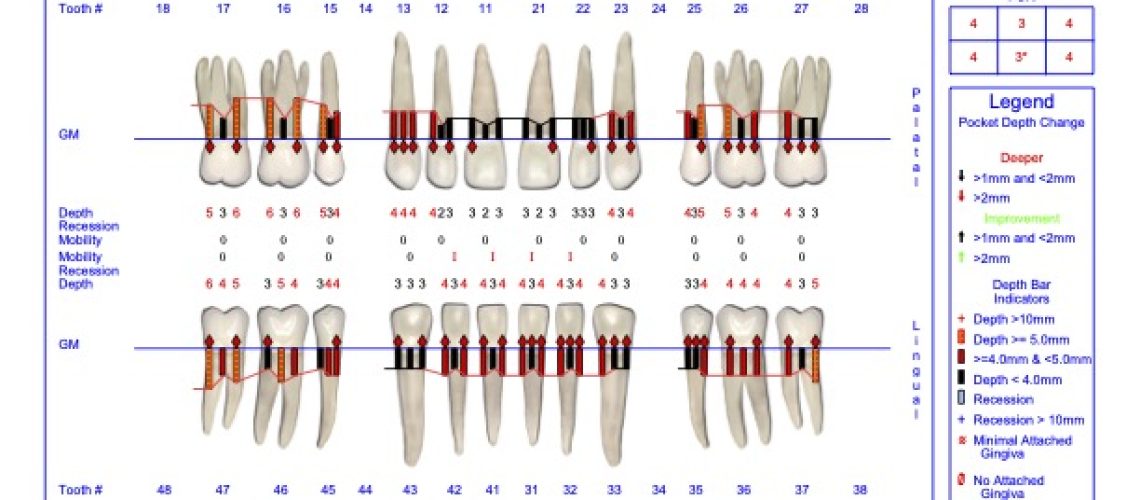 La Importancia de un Diagnóstico Temprano en la Periodoncia