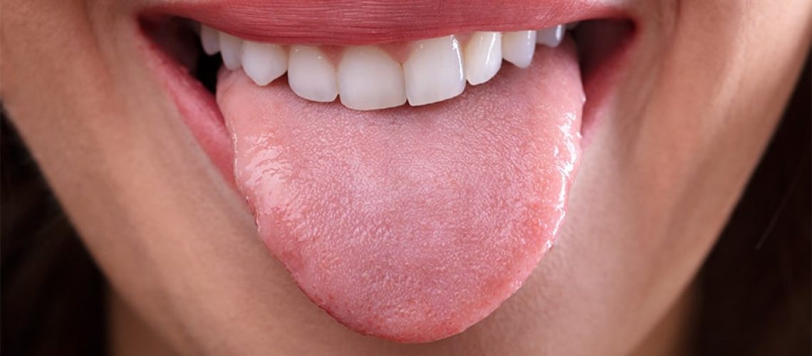 lengua sana