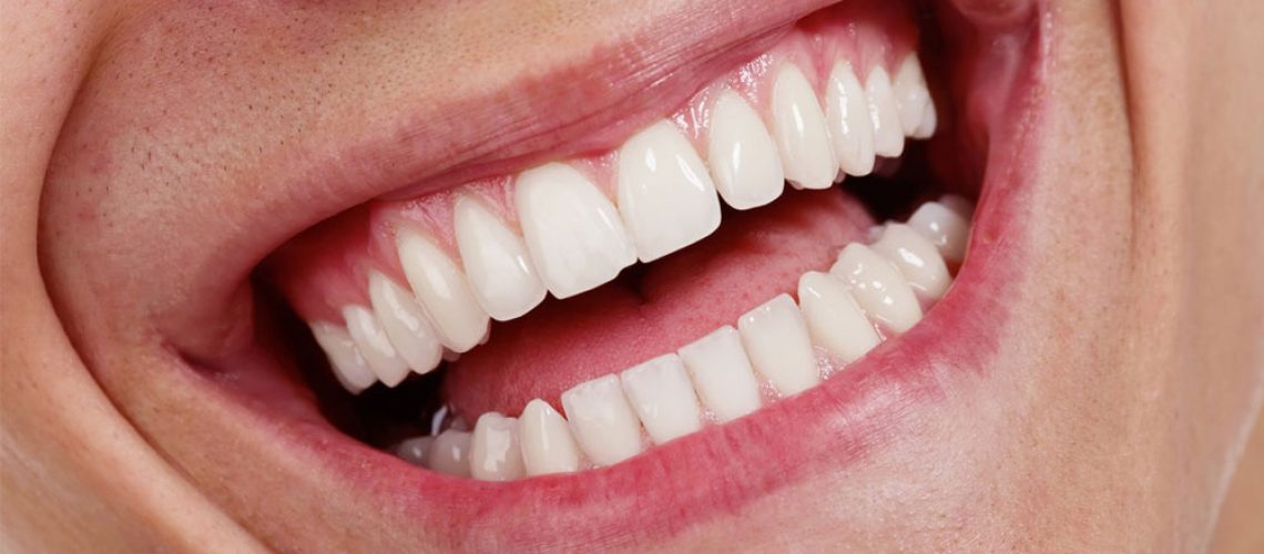 Rehabilitación dental completa: opciones y procesos